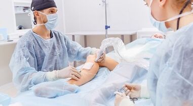 varicose surgery