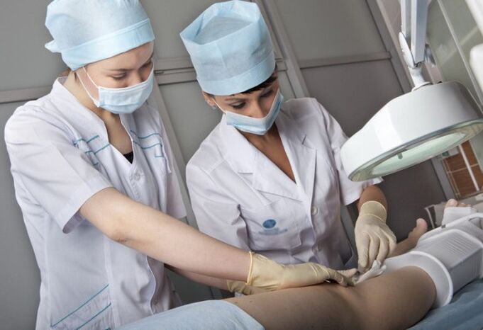 Performing an operation for varicose veins of the legs