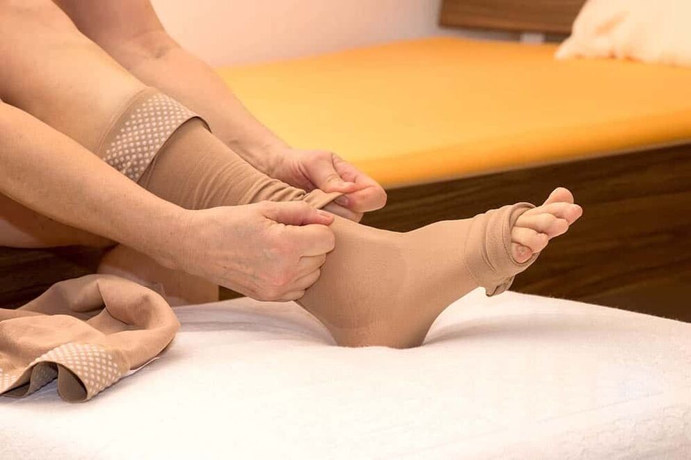 The use of compression hosiery will help alleviate the symptoms of varicose veins. 